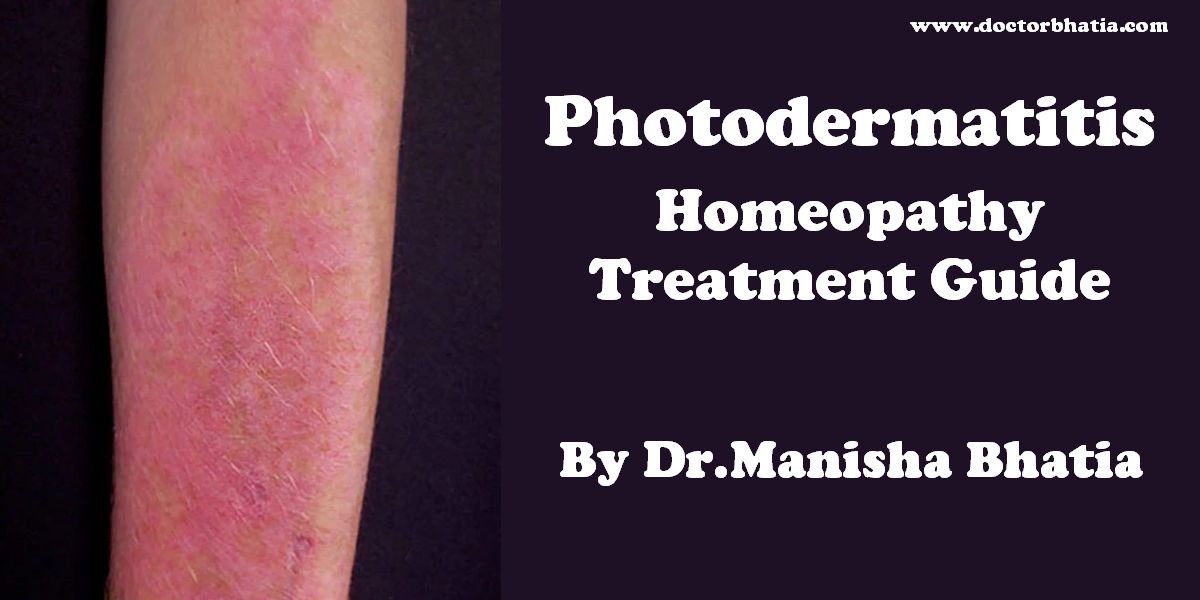 Tinea (Athlete's foot) - Homeopathy Treatment and Homeopathic