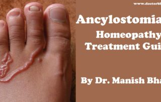Tinea (Athlete's foot) - Homeopathy Treatment and Homeopathic